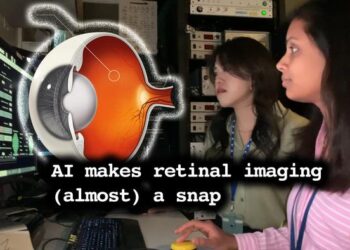 AI makes retinal imaging (almost) a snap