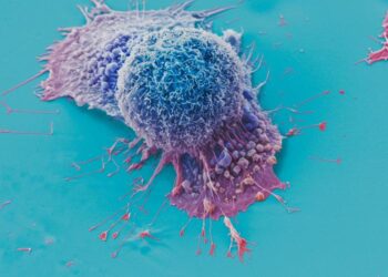 Election micrograph of lung cancer cells