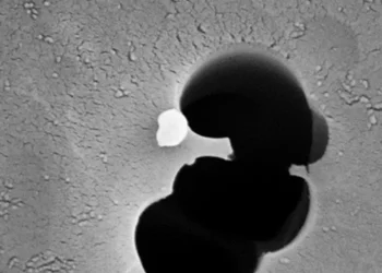 Silver nanoparticle