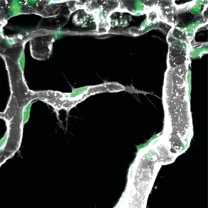 Image of active pioneer cell (center of image). Green indicates endothelial cell nucleus, grey the outline of the blood vessels. (Photo: Zoological Institute, KIT)