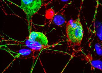 Cell’s ‘Garbage Disposal’ May Have Another Role: Helping Neurons Near Skin Sense the Environment