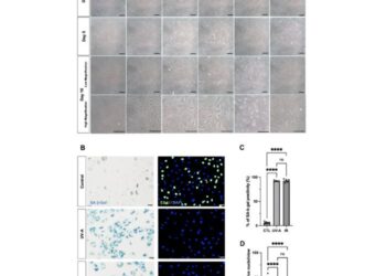 Cover paper: Senescent characteristics of human corneal endothelial cells upon