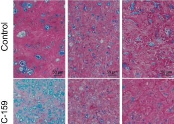 Wnt inhibitor impact on cancer cells