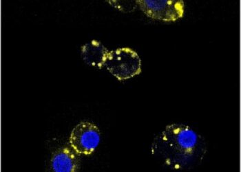 Experimental type 1 diabetes drug shelters pancreas cells from immune