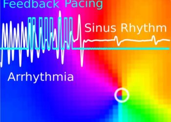 Arrhythmia_optogenetics