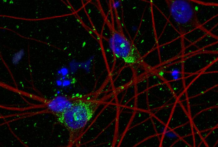 Staining of human stem-cell derived neurons shows DNA in cell nuclei (blue), neuron cytoskeleton (red), and tau aggregates (green)