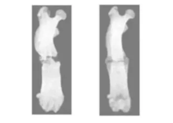 Effect of plasma irradiation on broken bone