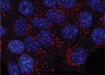 Cancer cells gathering lipid droplets