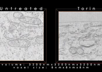 Enhanced FIB-SEM images of untreated and nutrient-starved cells (400 voxels)