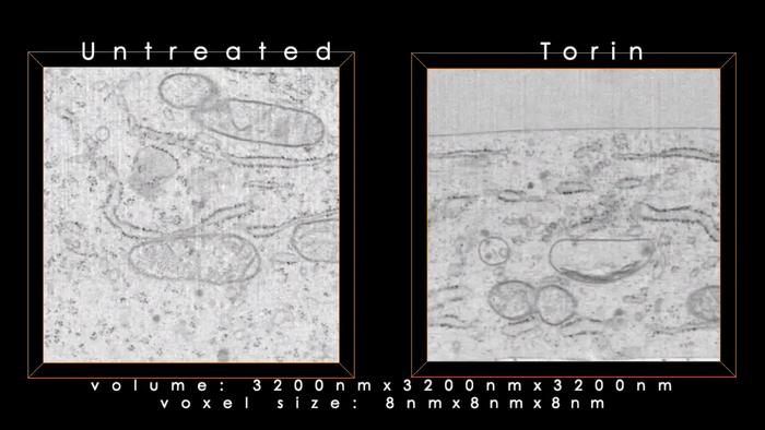 Enhanced FIB-SEM images of untreated and nutrient-starved cells (400 voxels)