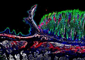 Gastroesophageal Junction