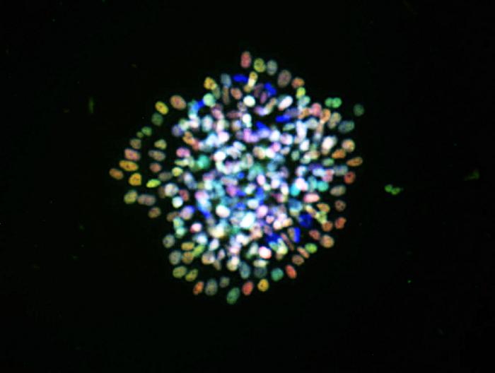 nephron progenitor cells