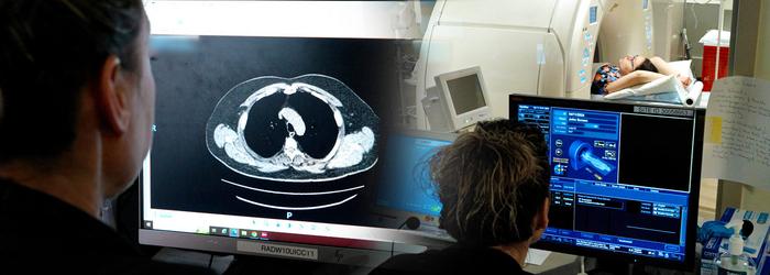 Lung Cancer Low-dose CT Screening