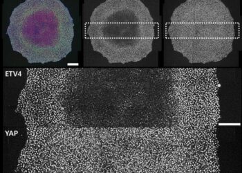 Microscopic depiction showcasing ETV4 expression dynamics in human embryonic stem cells influenced by variations in cell density