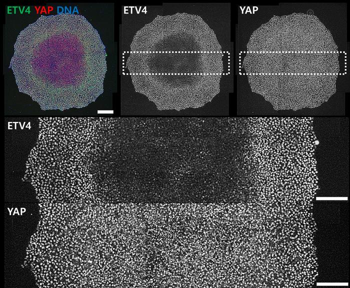 Microscopic depiction showcasing ETV4 expression dynamics in human embryonic stem cells influenced by variations in cell density