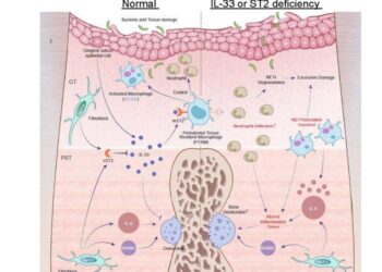 Fig1: Schematic illustration of inflammatory gene expression profiles in the course of periodontitis and the role of the IL-33/ST2 axis against acute inflammation.