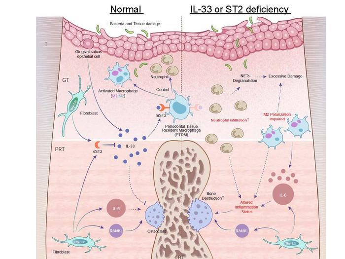 Fig1: Schematic illustration of inflammatory gene expression profiles in the course of periodontitis and the role of the IL-33/ST2 axis against acute inflammation.