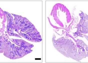 APS-1 mouse lung sections