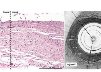 Ureteral electrothermal injury, characterized by damaged collagen bundles, with swelling and fragmentation of smooth muscle fibers, is visible via histology ex vivo (left panel, 20× magnification).