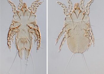 The new feather mite Metanalges agachi