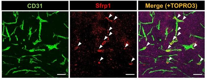 Tumor blood vessels produce the angiocrine factor, Sfrp1.