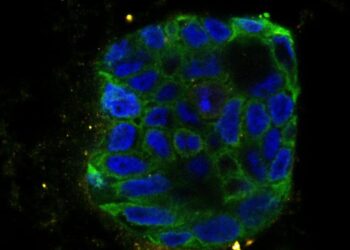 Organoid of a patient with colon cancer