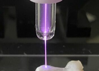 Ruptured Achilles tendon shows faster repair amid plasma irradiation treatment