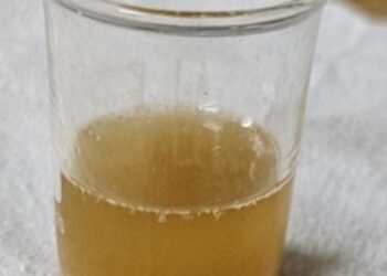 Scientists convert chicken fat into energy storage devices