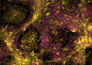 Fluorescently labelled mutant stem cells differentiated toward sympathetic neurons. Image recorded by Dr. Ingrid Saldana