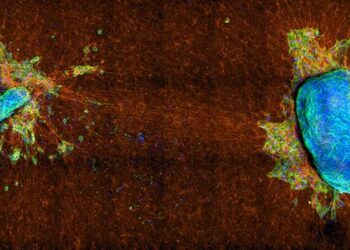 Two malignant mixed mullerian tumor explants on collagen network