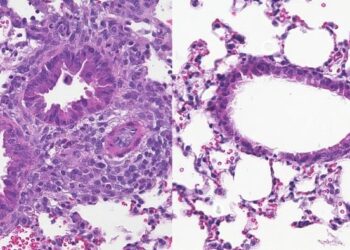 ILC2s in the lungs