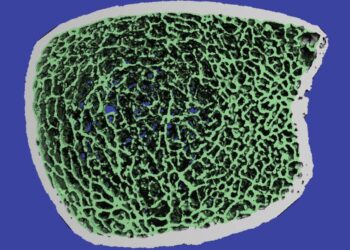 Bone Microarchitecture