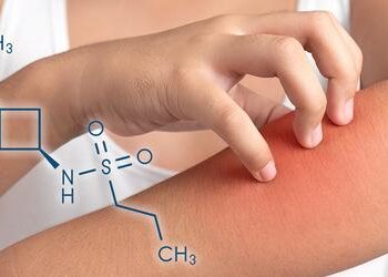 Drug Used to Treat Eczema May Provide Relief for Patients with Intensely Itchy Skin Diseases