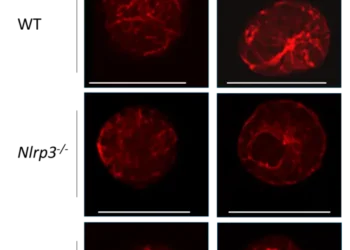 Role of inflammasome proteins: NLRP3 and ASC