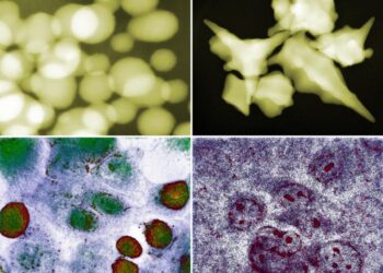 Gold nanoparticles interact with cancer cells