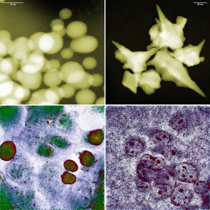 Gold nanoparticles interact with cancer cells