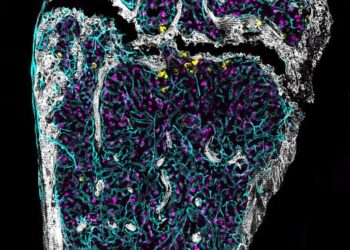 immunofluorescence image of a middle-aged femur