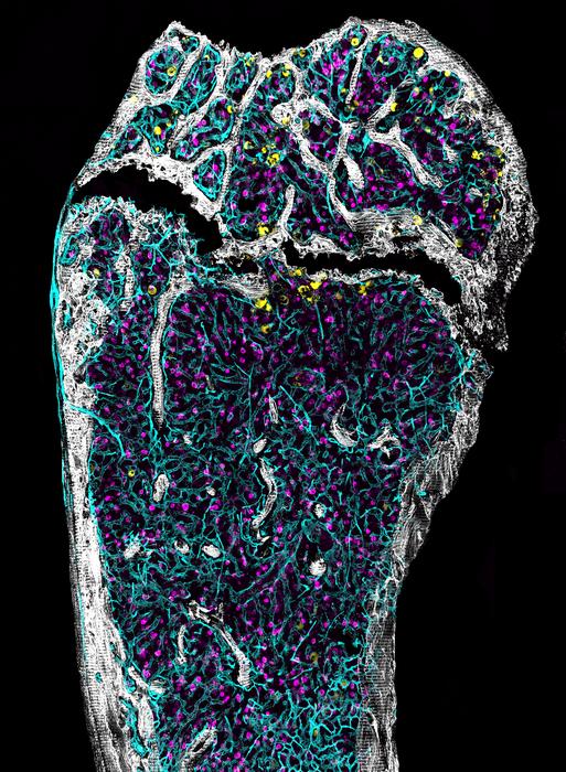 immunofluorescence image of a middle-aged femur