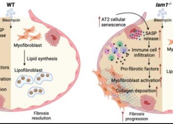 Proposed mechanism of action for ISM1 in regulating pulmonary fibrosis development and resolution using BIPF