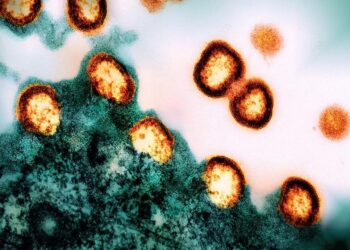 HIV-1 virus particles