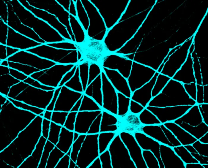 Human neurons derived from stem cells