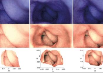 From blurry images to a 3D model