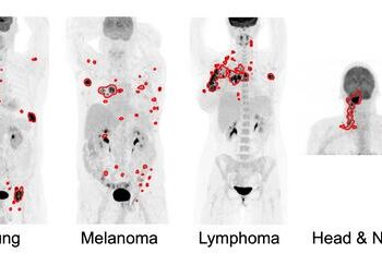 Illustrative examples of the predicted tumor segmentations by the deep transfer learning approach across six cancer types.