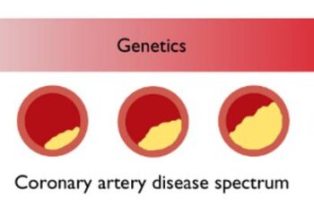 Coronary artery disease spectrum