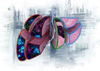 Image illustrating four prognostic scenarios that may be found in liver biopsies when pancreatic cancer is diagnosed before metastasis.