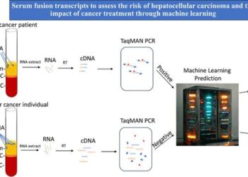 New Screening Tool Could Improve the Survival Rate of Patients with Hepatocellular Carcinoma from 20% to 90%