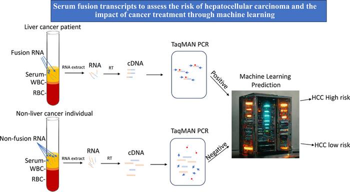 New Screening Tool Could Improve the Survival Rate of Patients with Hepatocellular Carcinoma from 20% to 90%