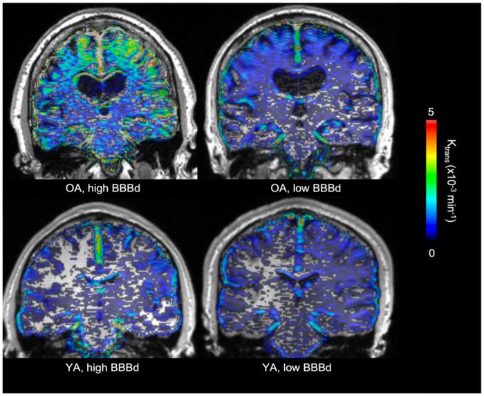 Associations between regional blood-brain barrier permeability, aging, and Alzheimer’s disease biomarkers in cognitively normal older adults