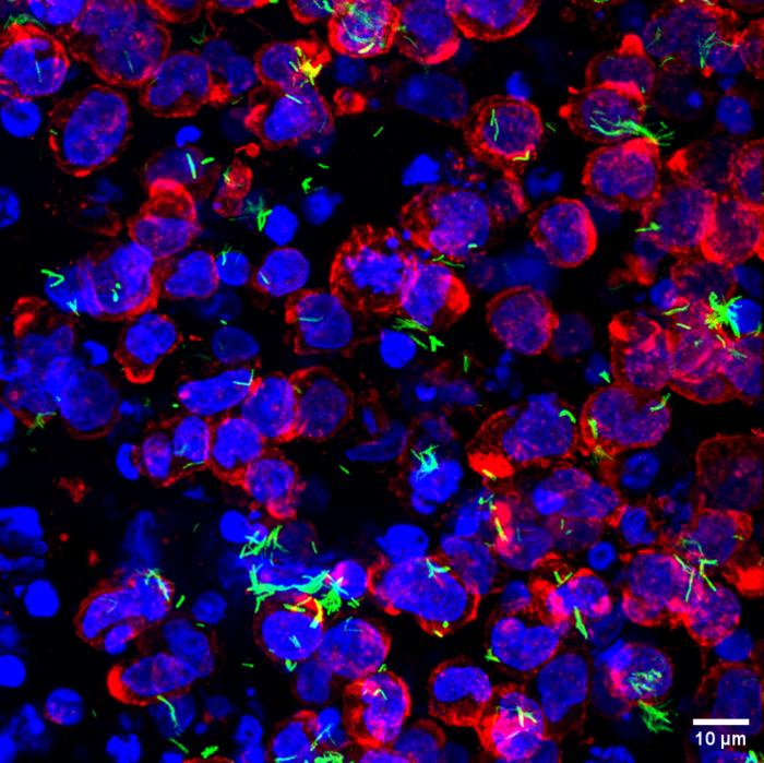 Human immune cells (nucleus: blue, cell boundary: red) with Mycobacterium tuberculosis (green) in the collagen hydrogels