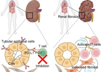 The role of autoinflammation in ciliopathies